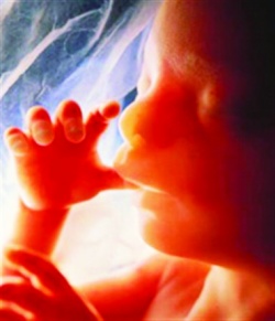 بر اساس آمار سال 98 ؛ اكثر سقط‌ جنين ها توسط زنان متمول صورت مي گيرد